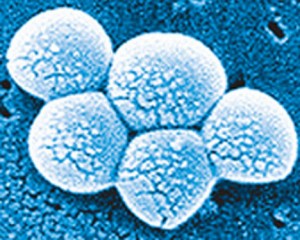 mrsa-bacterium