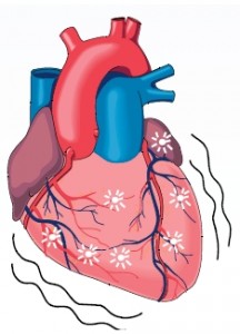 CardiacArrest