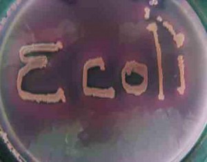 mac-ecoli-written-SIL